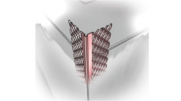 bmbtechnologie293831